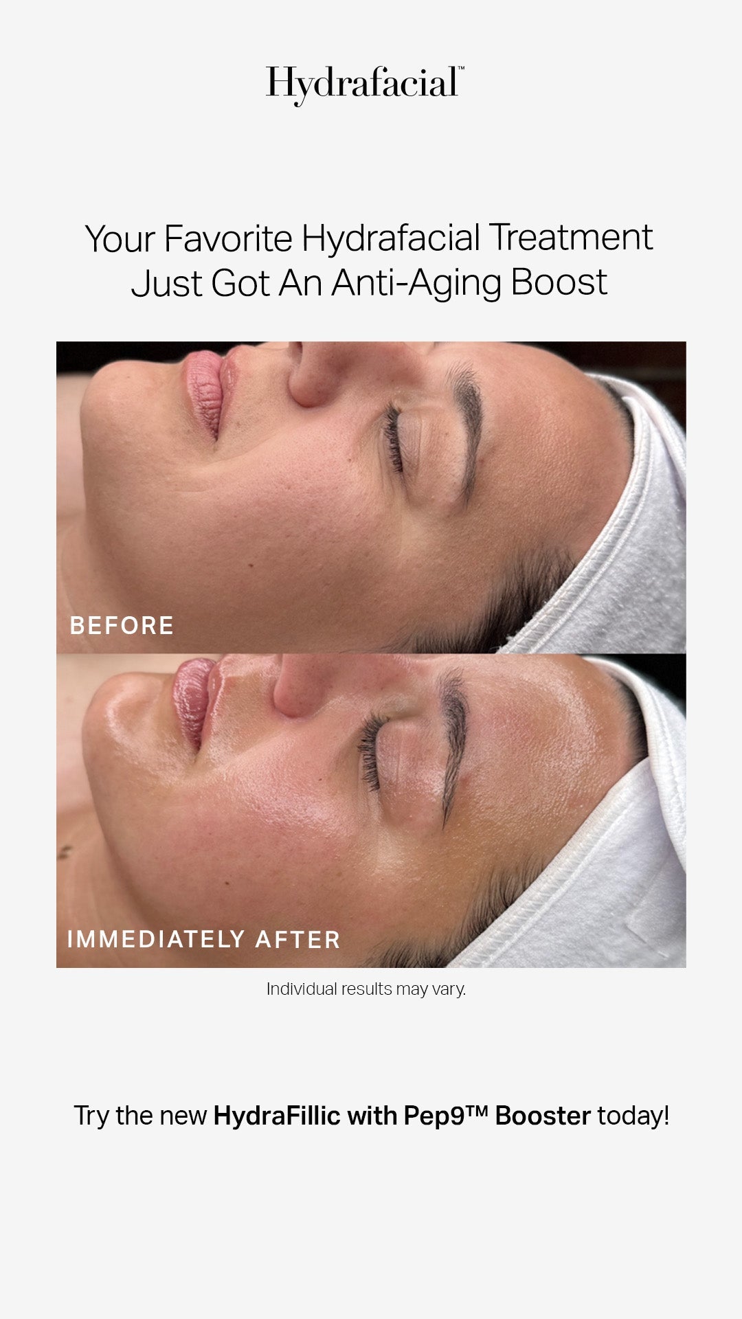 before and after of woman receiving Hydrafacial with Hydrafillic pep9 