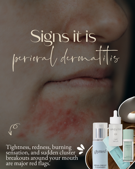 what is perioral dermatitis.  woman's face up close with a cluster of POD rash.  skincare products are in the bottom right corner.